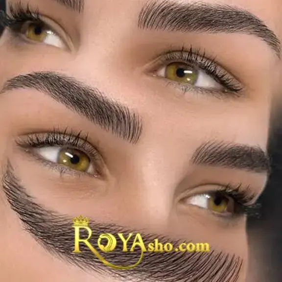 فیبروز ابرو چیست؟ راهنمای کامل ۱۴۰۵، مزایا، مراحل، هزینه و عوارض + عکس
