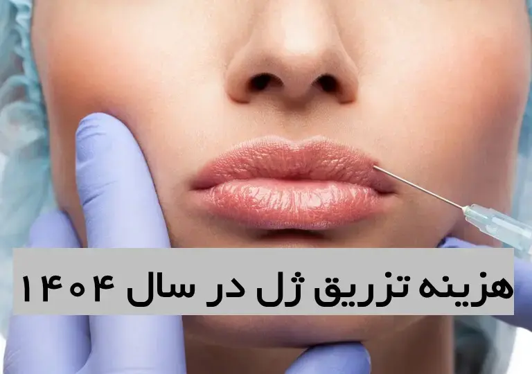 هزینه تزریق ژل در کلینیک‌های زیبایی تهران ۱۴۰۴