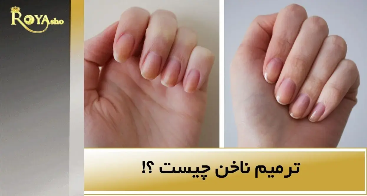 ترمیم ناخن چیست ؟!