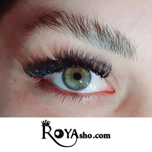 تفاوت اکستنشن والیوم با اکستنشن کلاسیک