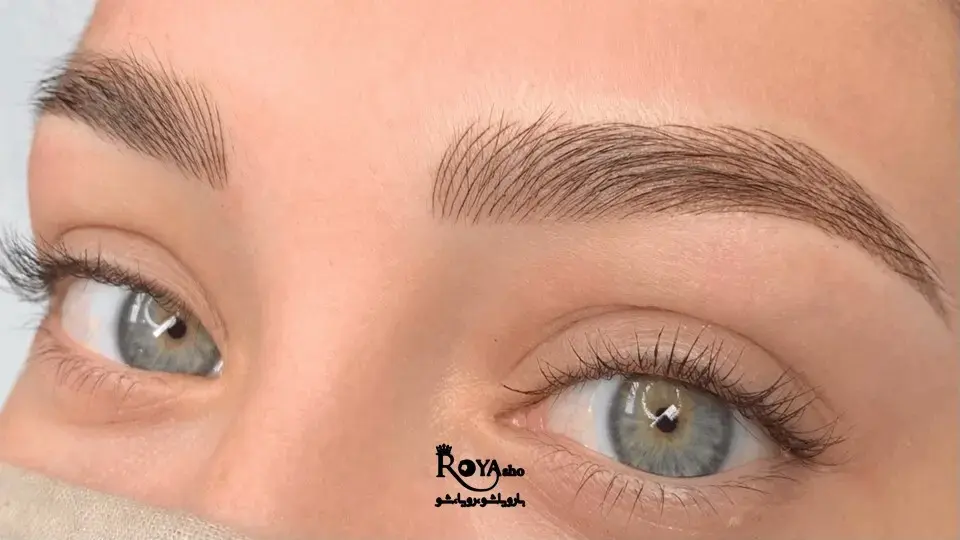 میکروبلیدینگ، فیبروز و کاشت ابرو در شهرک گلستان میکروبلیدینگ، فیبروز و کاشت ابرو در شهرک گلستان
