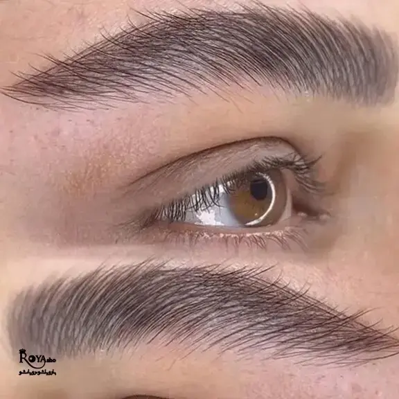 تفاوت فیبروز ابرو با میکروبلیدینگ ابرو