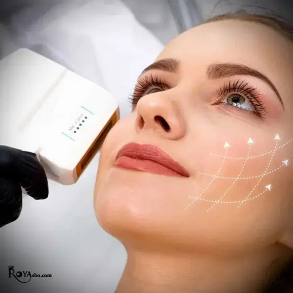هایفوتراپی یکی از پیشرفته‌ترین روش‌های جوانسازی و لیفت پوست است که بدون نیاز به جراحی، بخیه یا بیهوشی انجام می‌شود.