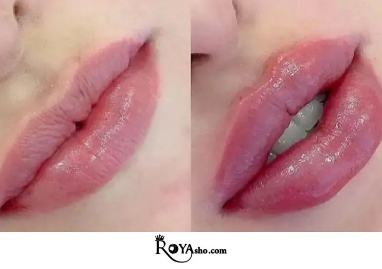 به‌طور متوسط، ماندگاری ژل لب بین ۶ تا ۱۲ ماه است