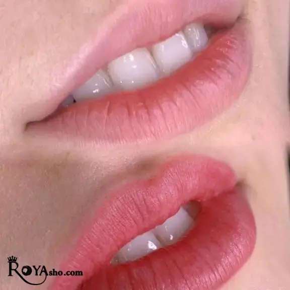 تاریخچه شیدینگ لب