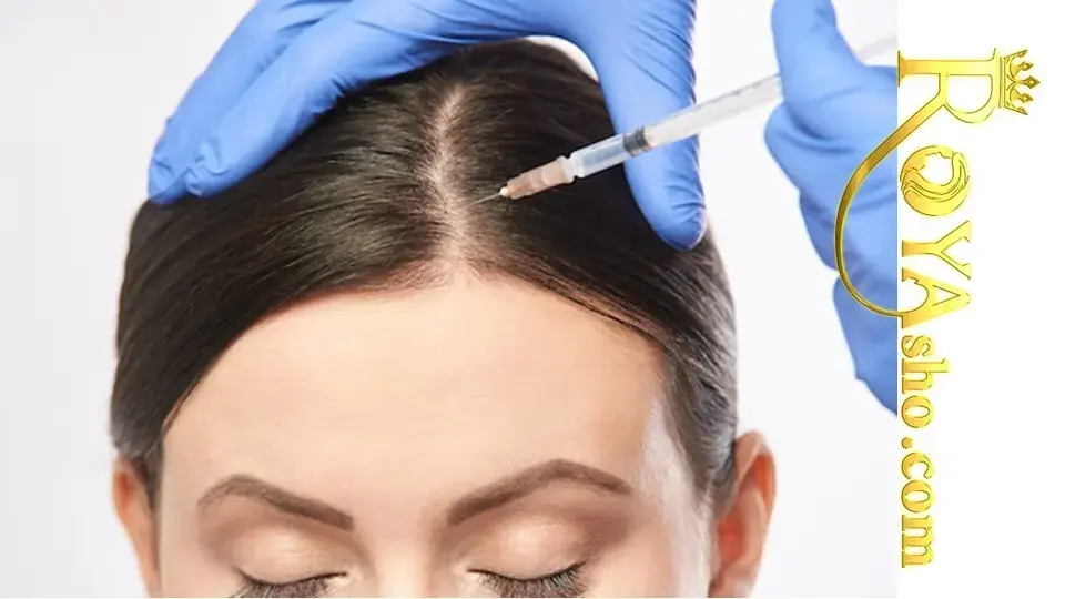 انواع احیا مو انواع احیا مو