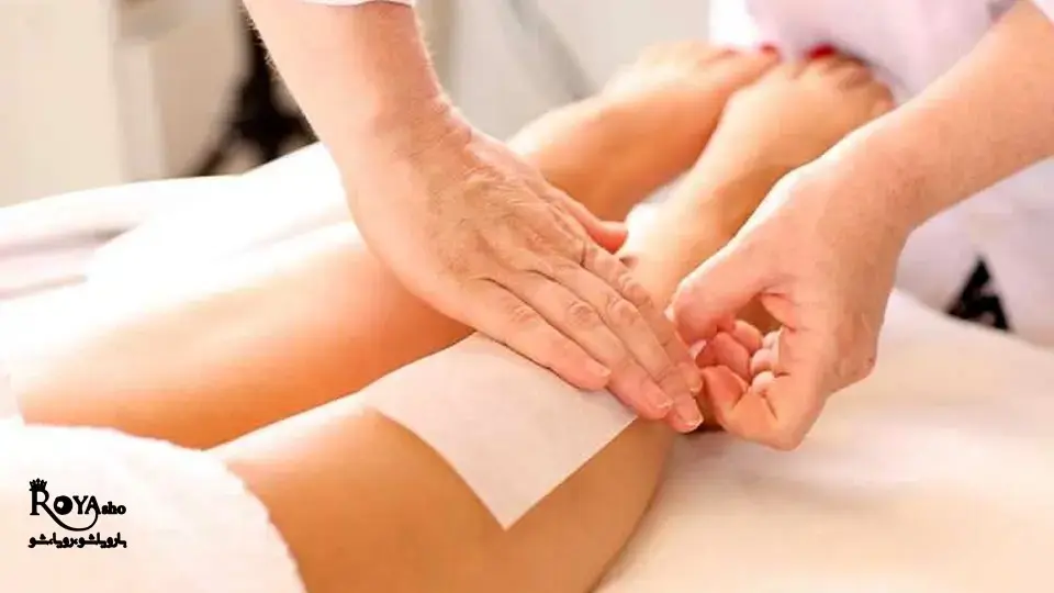 اپیلاسیون در غرب تهران