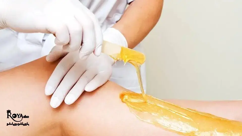 مرکز برتر اپیلاسیون در غرب تهران