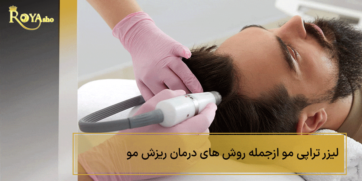 لیزر تراپی مو | روش های درمان ریزش مو