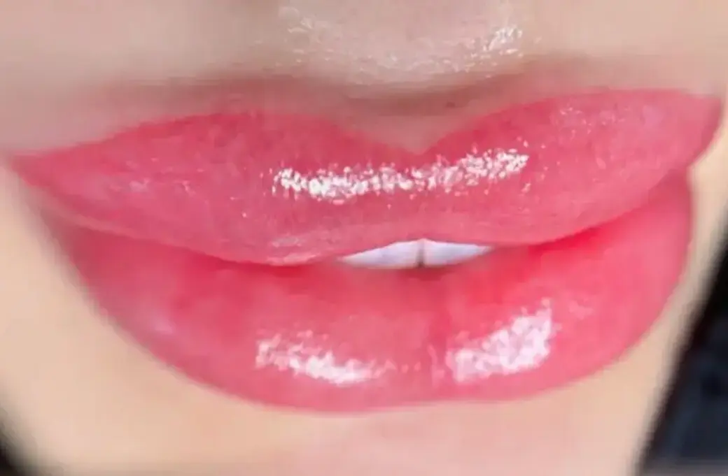 شیدینگ لب شیدینگ لب (Lip Shading) یکی از مدرنترین و پرطرفدارترین روشهای زیباسازی لب است که به جای ایجاد یک خط لب پررنگ و مصنوعی، رنگی ملایم، پودری و بسیار طبیعی را به بافت لب تزریق میکند