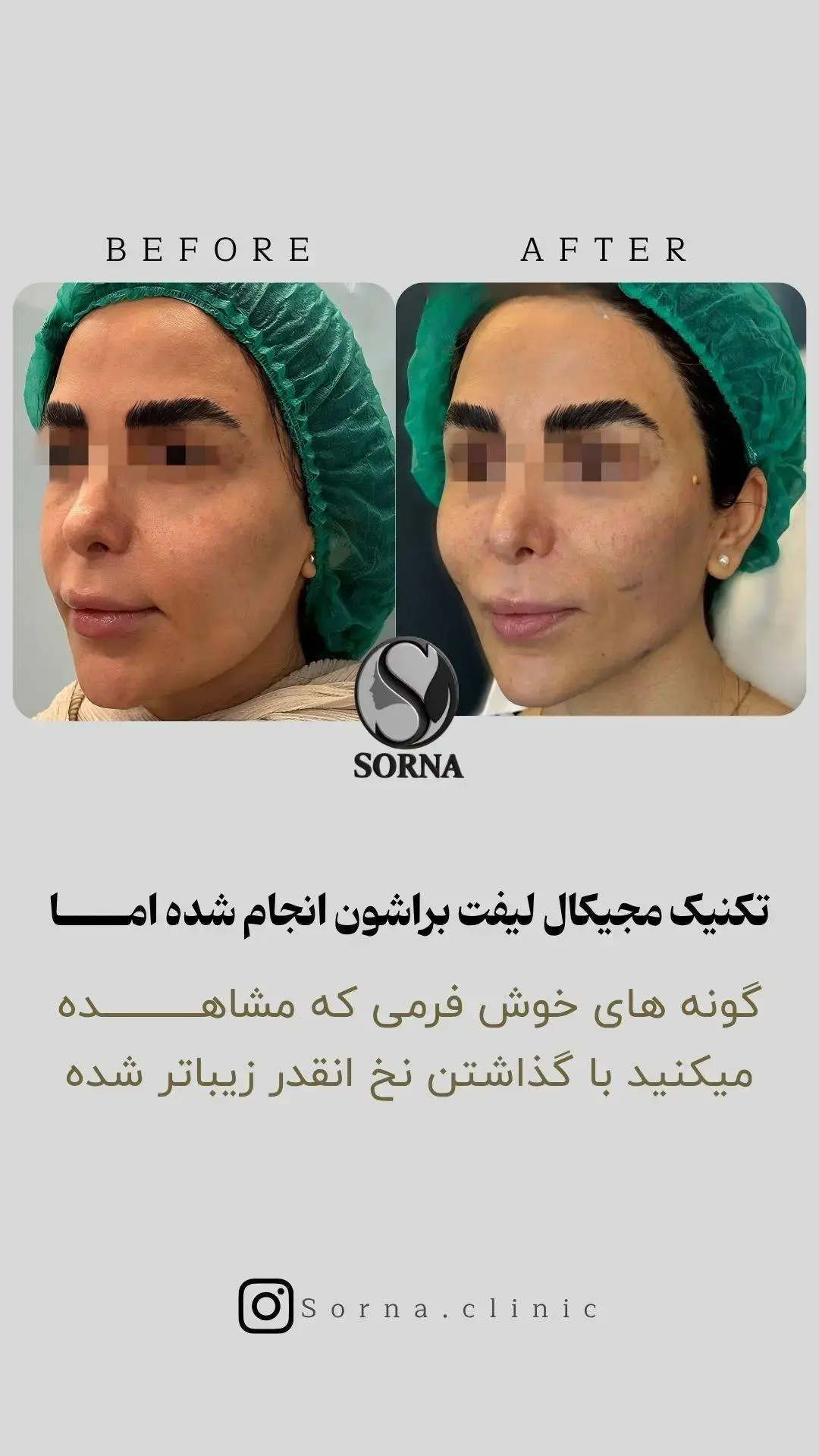 کلینیک زیبایی سرنا