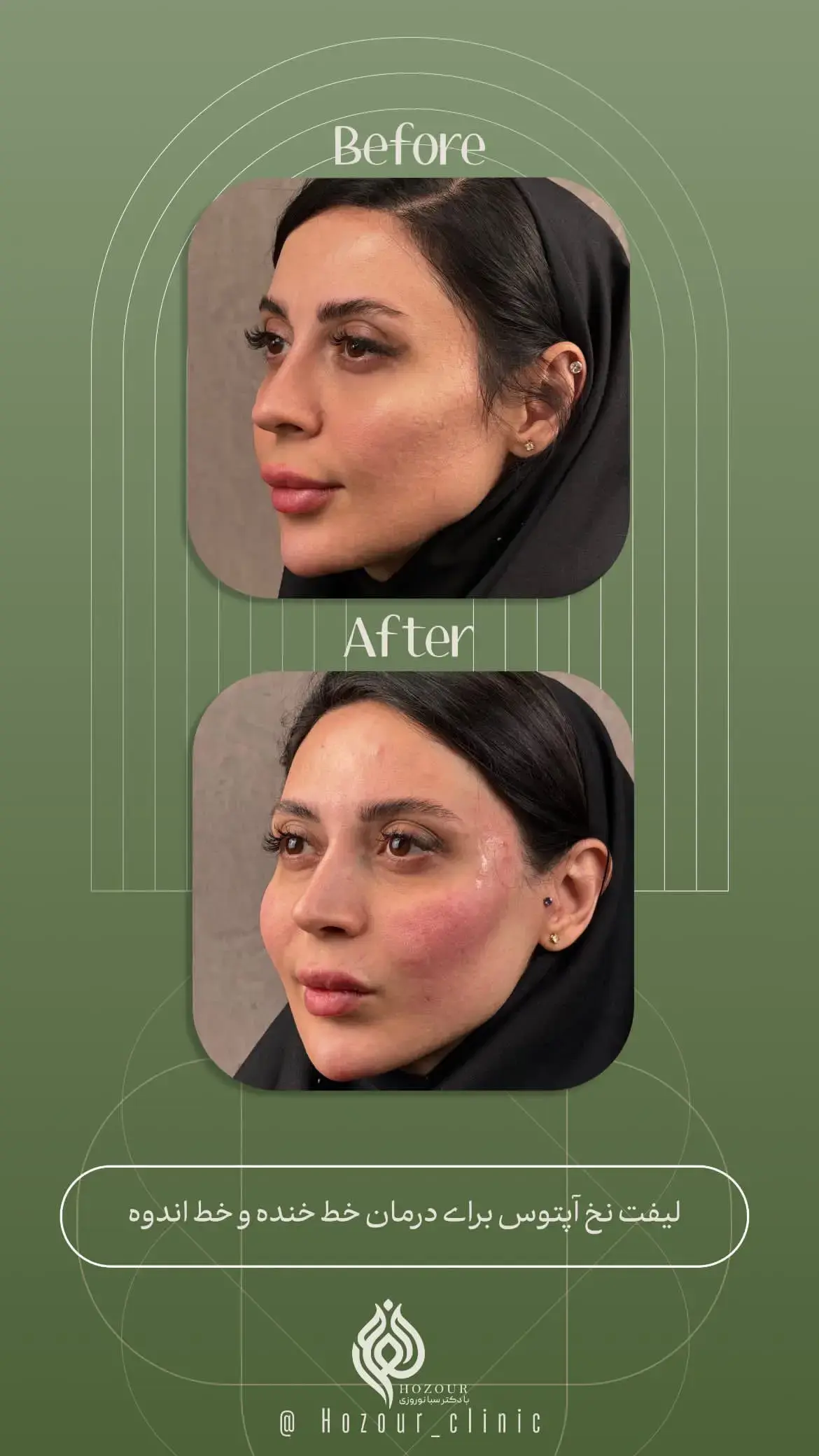 کلینیک زیبایی حضور