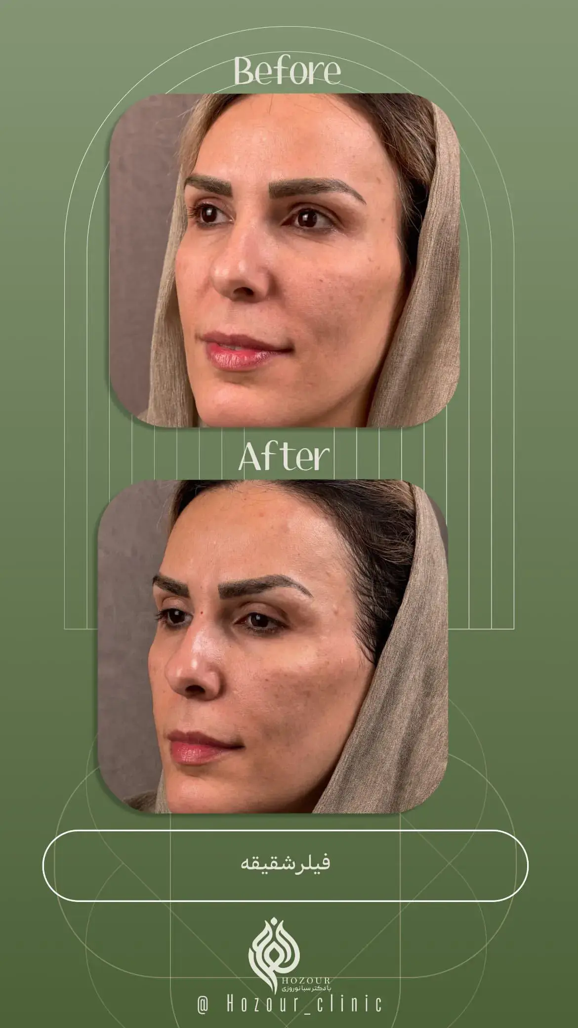 کلینیک زیبایی حضور