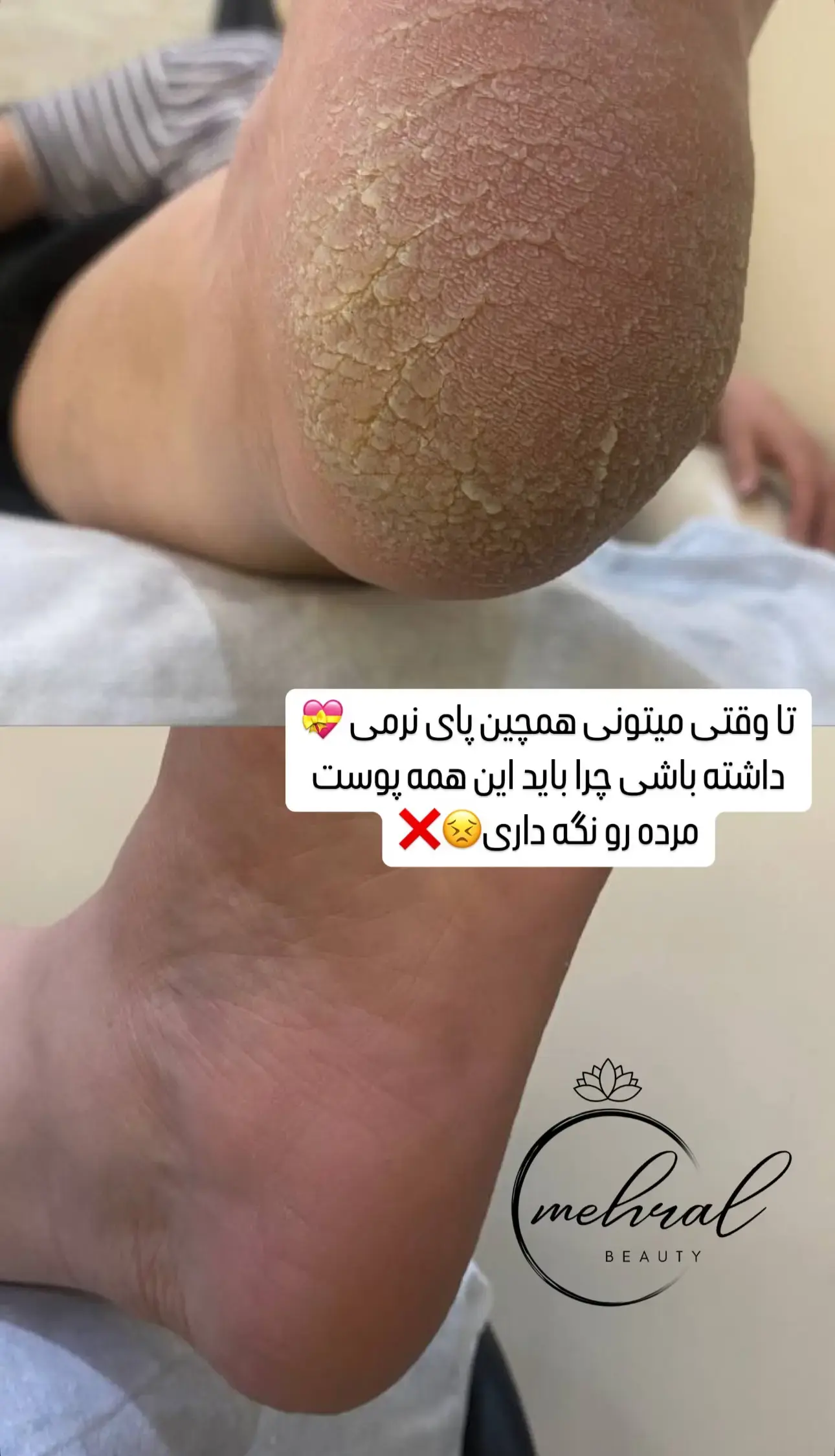 سالن زیبایی vip مهرال