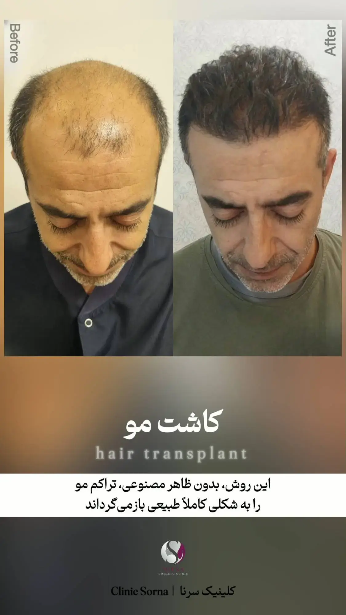 کلینیک زیبایی سرنا