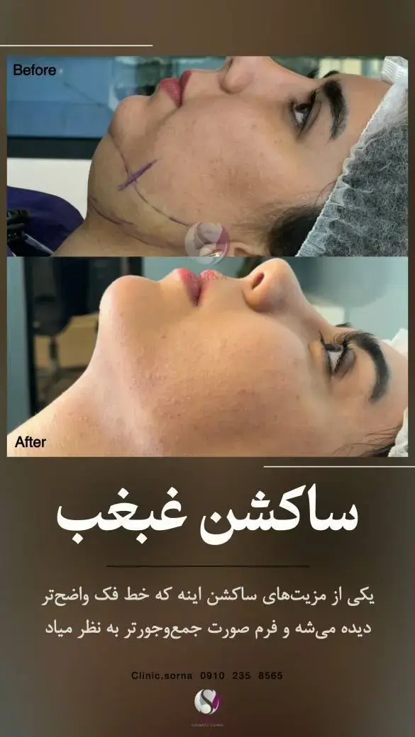 کلینیک زیبایی سرنا