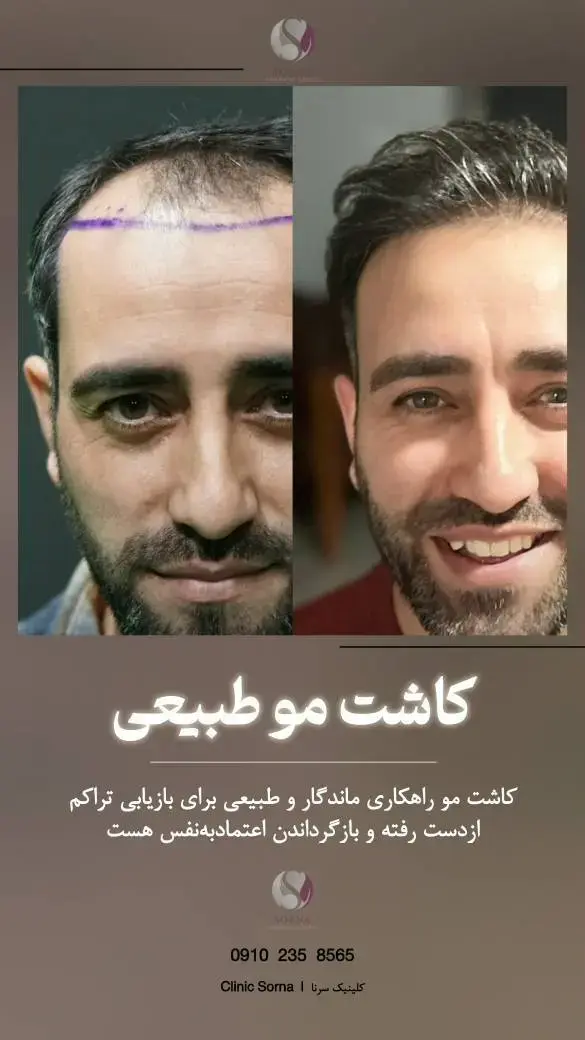کلینیک زیبایی سرنا
