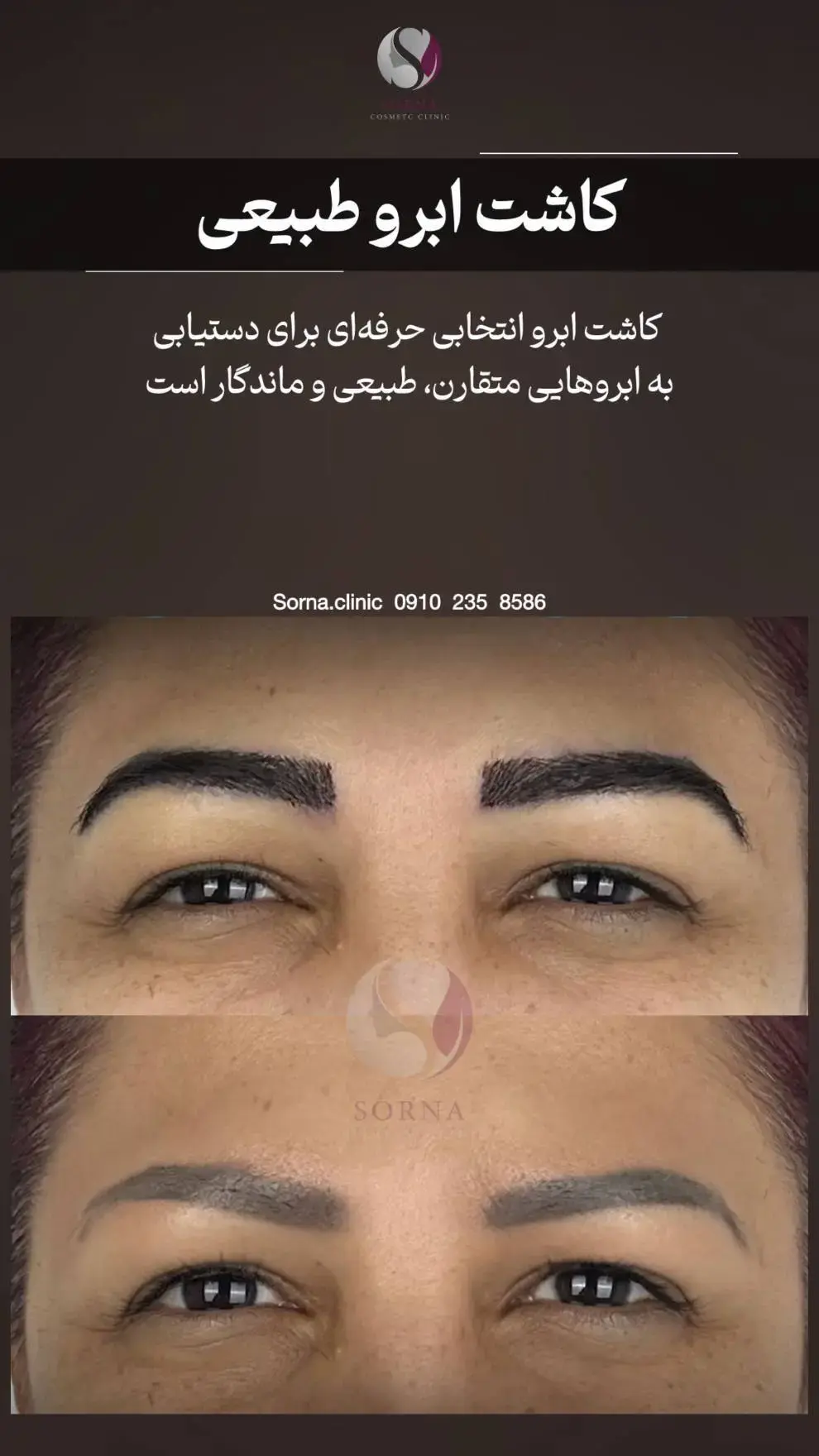 کلینیک زیبایی سرنا