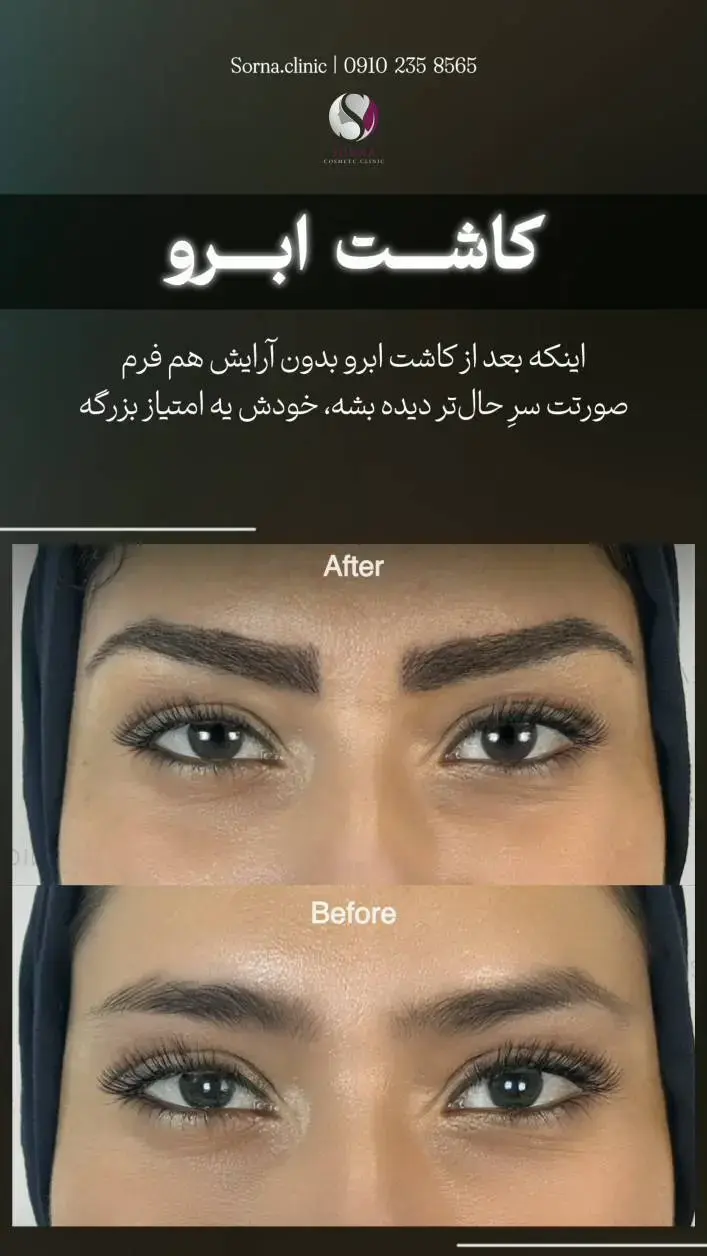 کلینیک زیبایی سرنا