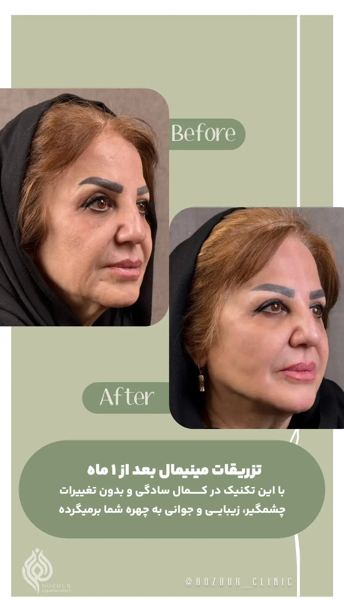کلینیک زیبایی حضور