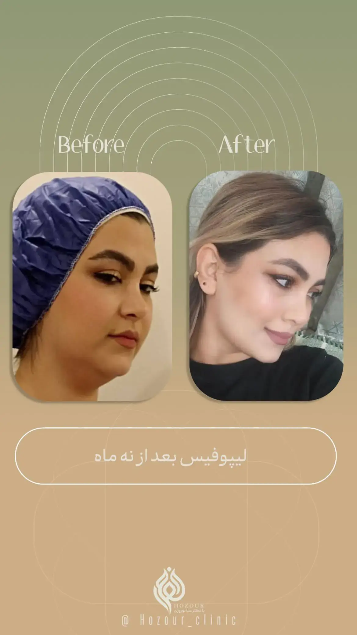کلینیک زیبایی حضور