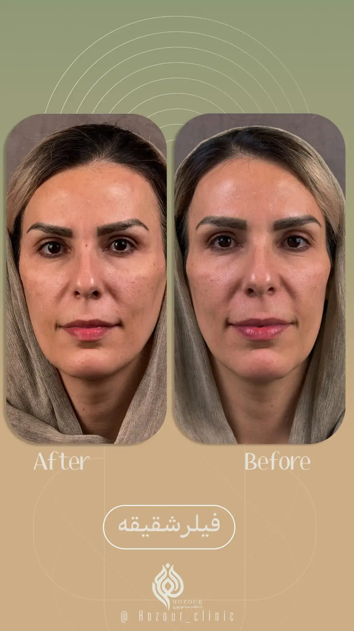 کلینیک زیبایی حضور