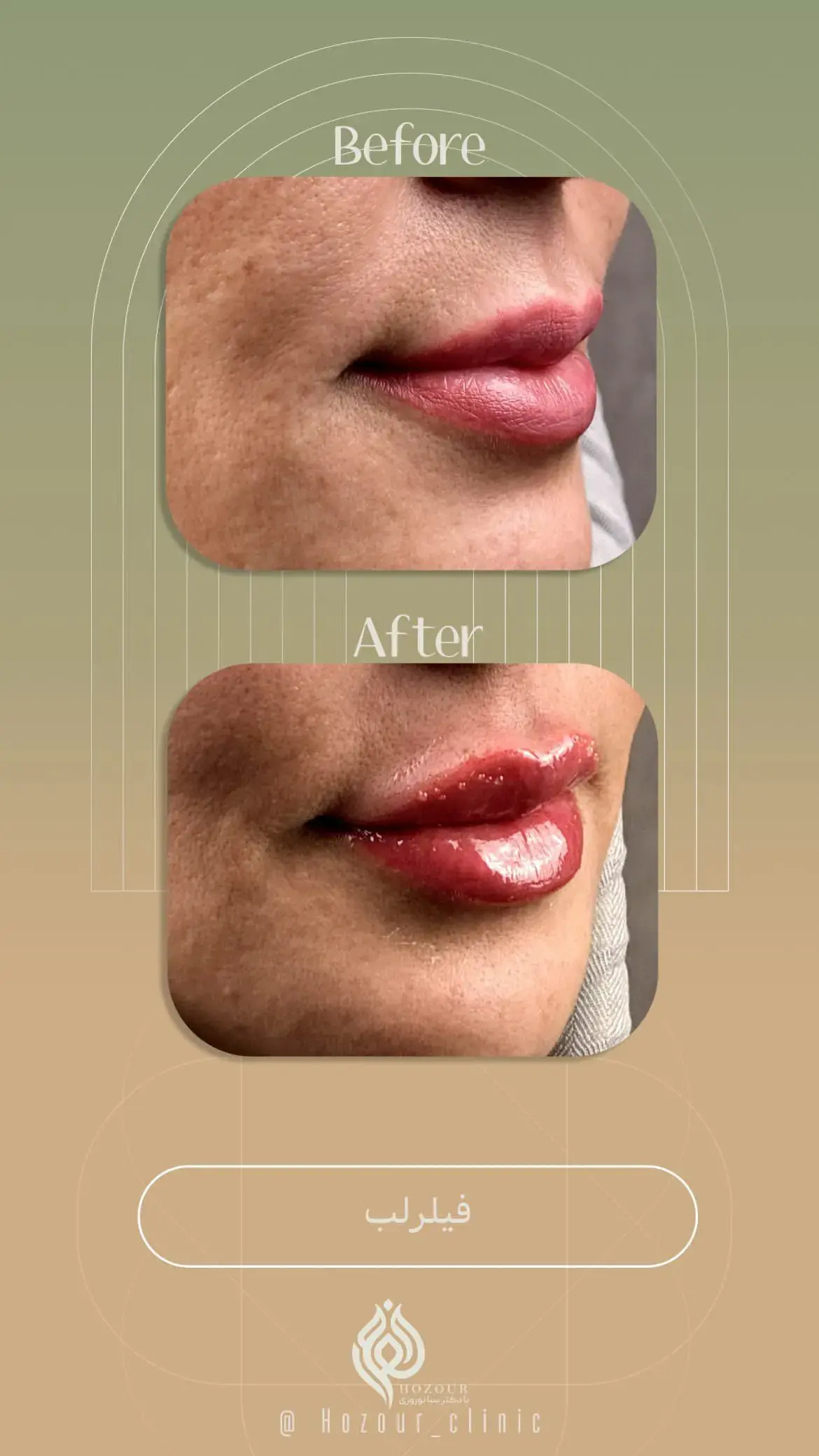 کلینیک زیبایی حضور