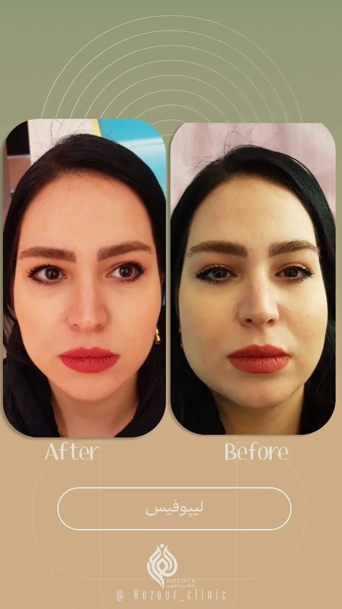کلینیک زیبایی حضور