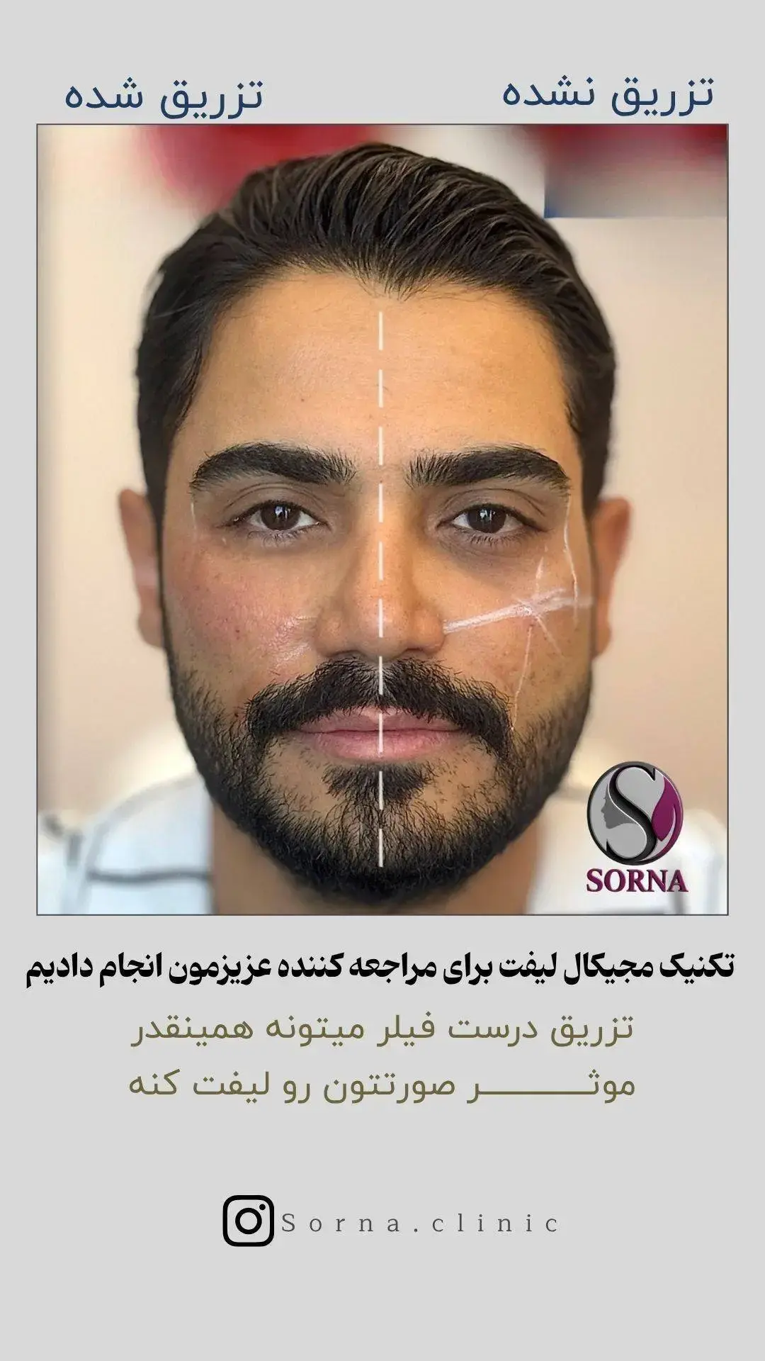 کلینیک زیبایی سرنا