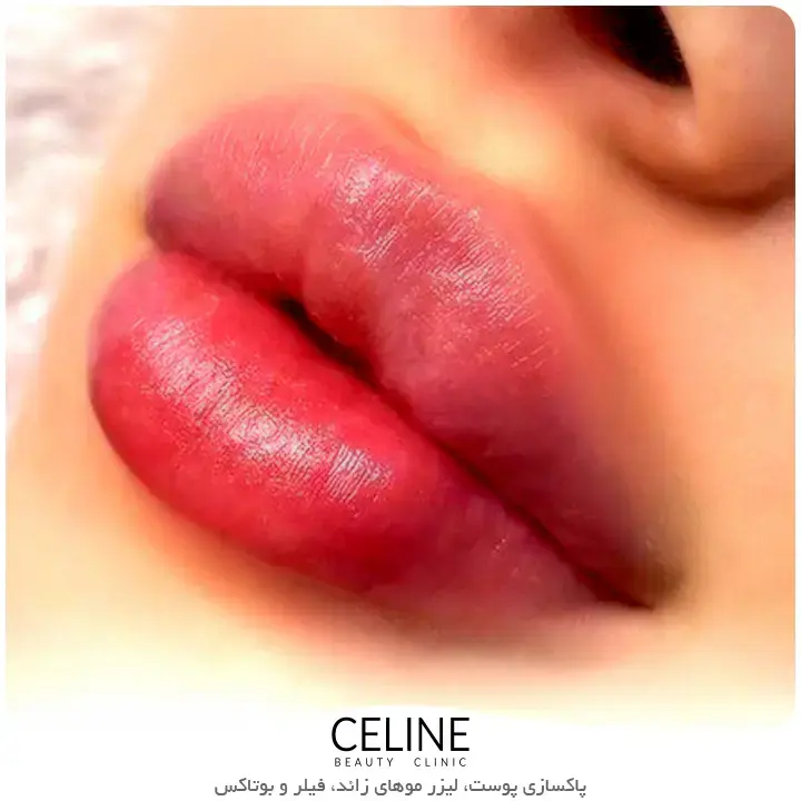 کلینیک زیبایی سلین بلوار فردوس