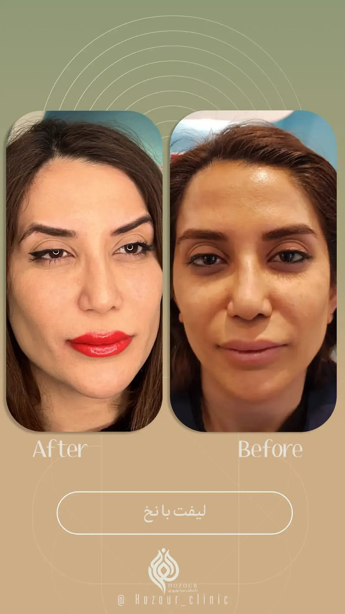 کلینیک زیبایی حضور