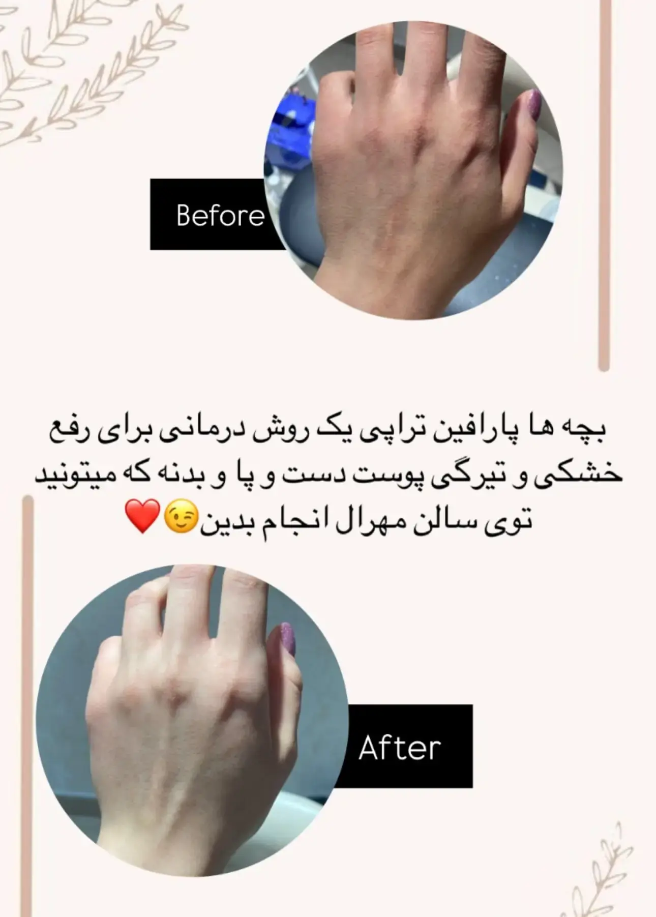 سالن زیبایی vip مهرال