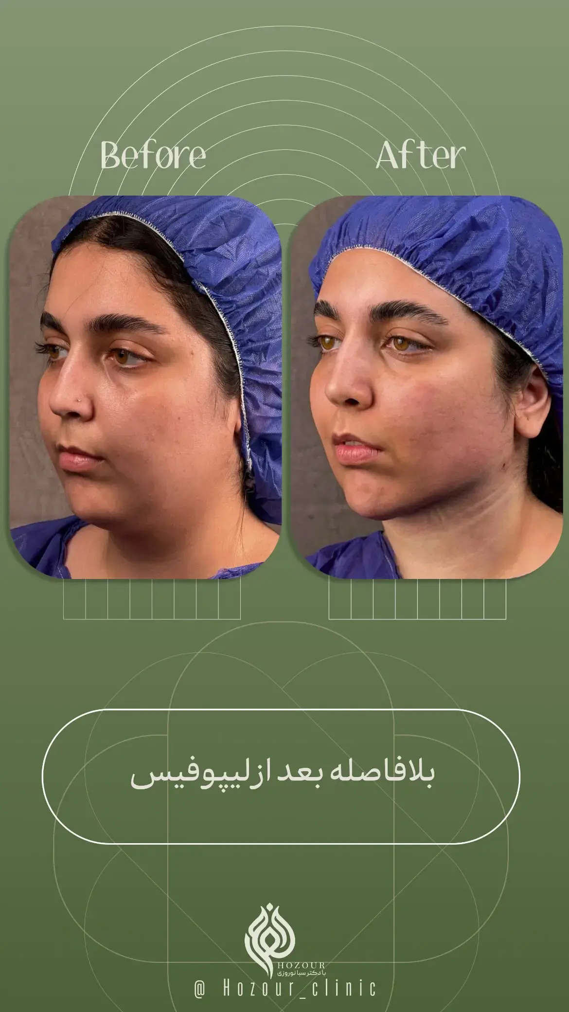 کلینیک زیبایی حضور
